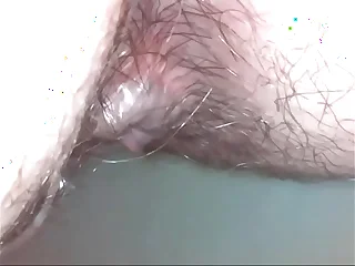 Nonconforming medical endoscope detection of this sweaty increased by dirty ass hole